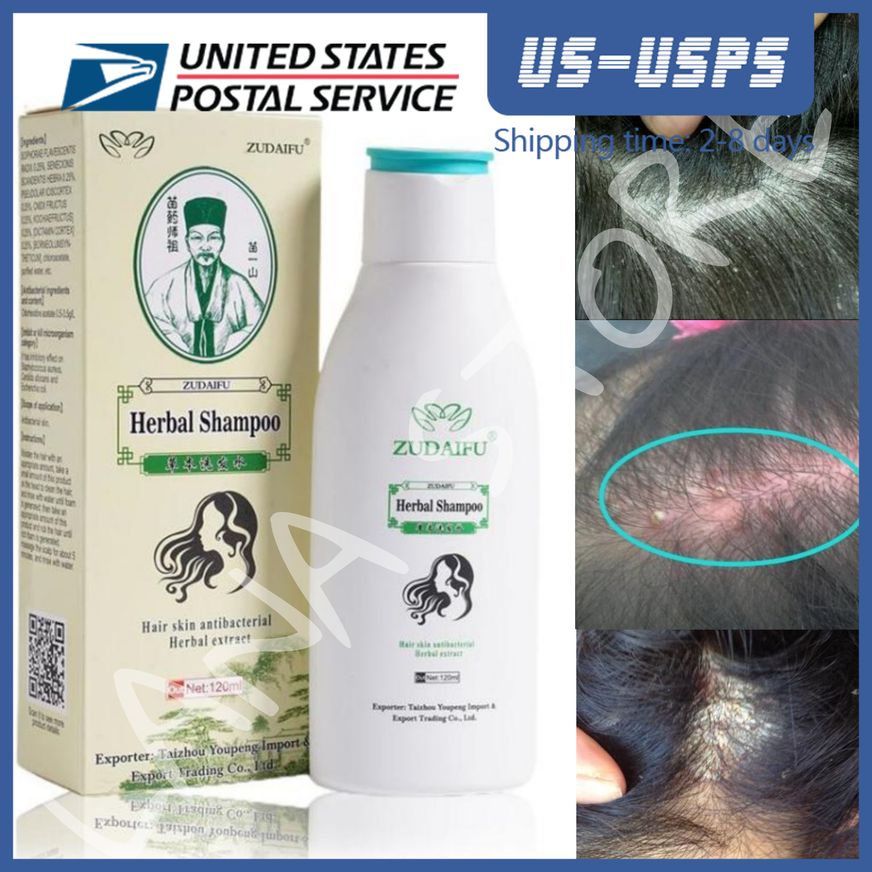 shop with crypto buy Zudaifu Hair Psoriasis Seborrheic Skin Care Treatment Dermatitis Eczema Compound Herbal Shampoo 120ML pay with bitcoin