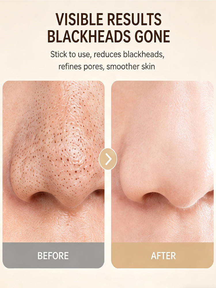 Blackhead Remover Vacuum Pore Cleaner - Electric Facial Skin Care Device for Blackhead & Acne Removal - Image 5