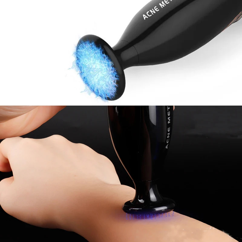Blue Light Plasma Pen Acne Removal Device 5 Levels Skin Tag Mole Spot Remover Pore Minimizer Facial Tightening Beauty Tool