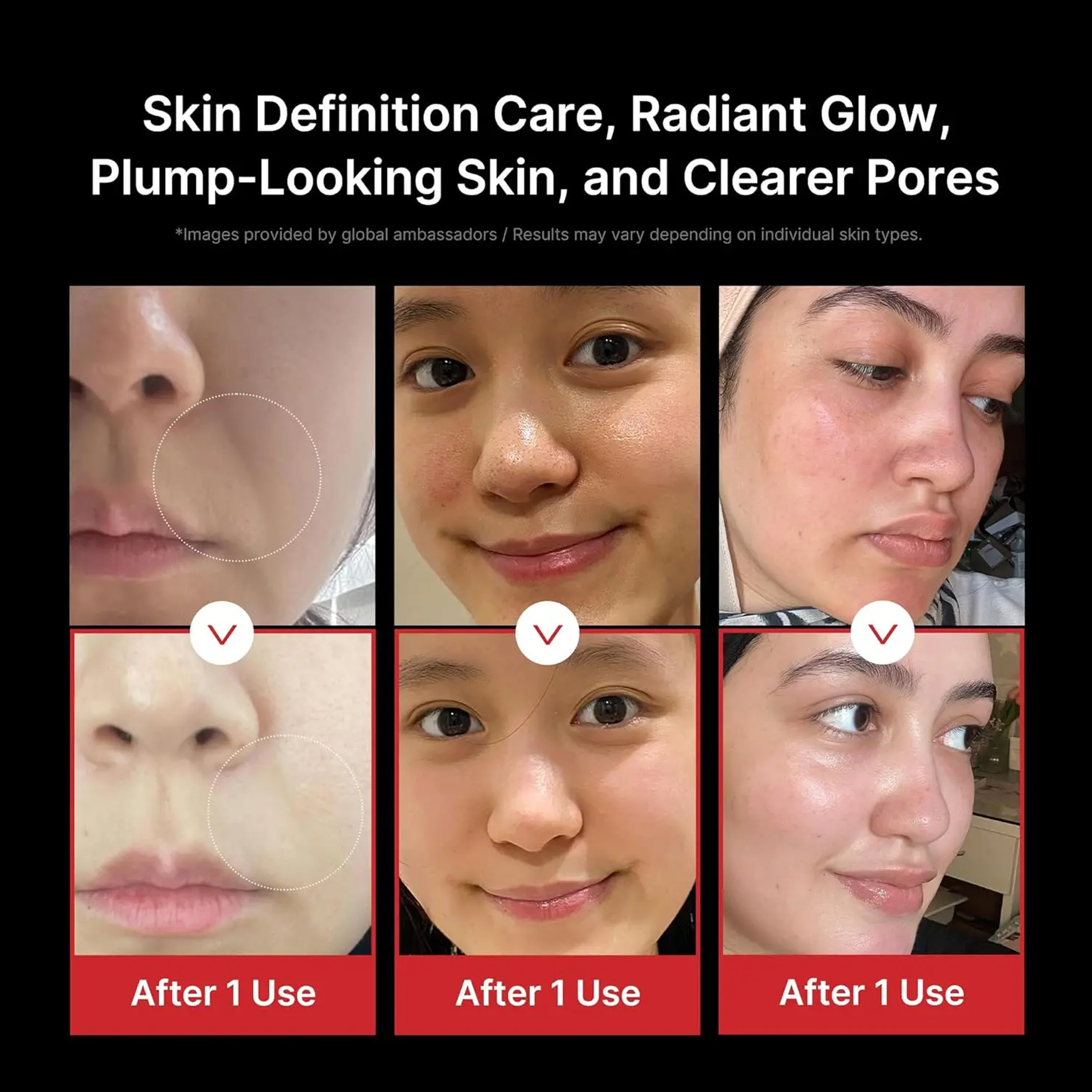 Booster Pro Led Facial Light Therapy EMS Microcurrent Facial Skin Care Facial Massager RF Facial  High Frequency Face Lifting - Image 5