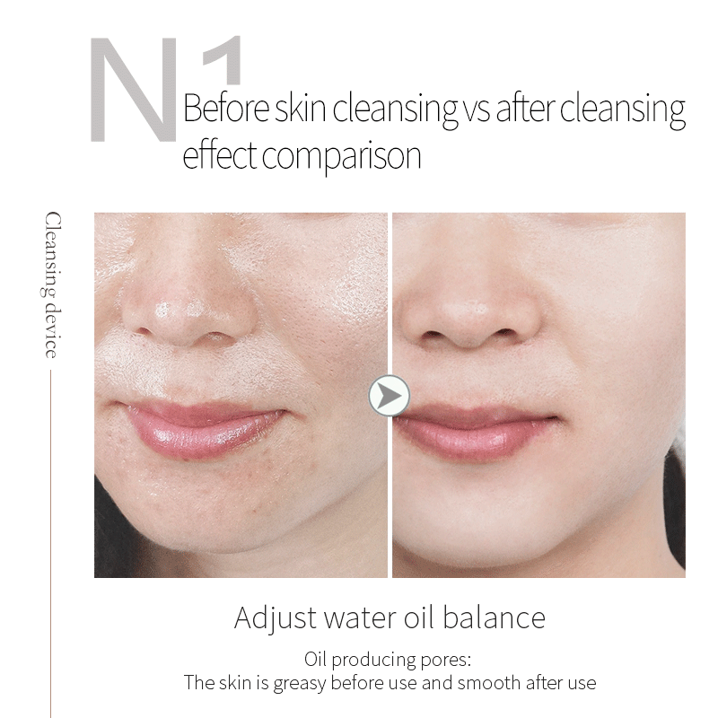 Professional Oxygen Magic Bubble Cleansing Machine Salon Skincare SPA Tool Deep Facial Cleansing Pores Water Oil Balance - Image 5