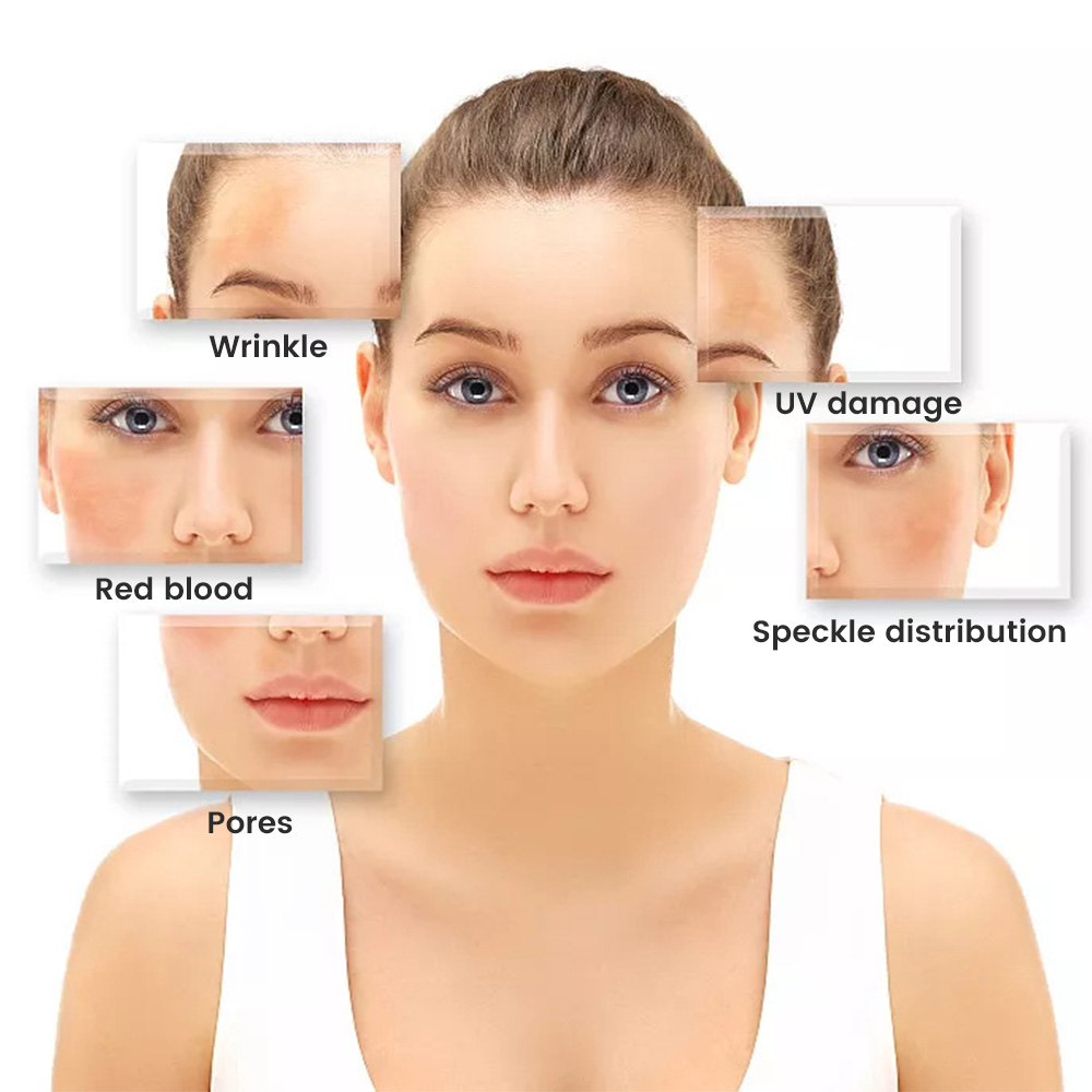 USB Dermatoscope Skin Analyzer Machine Facial Professional Aesthetic Skin Diagnostic Machine Scalp Electronic Microscope Beauty - Image 4