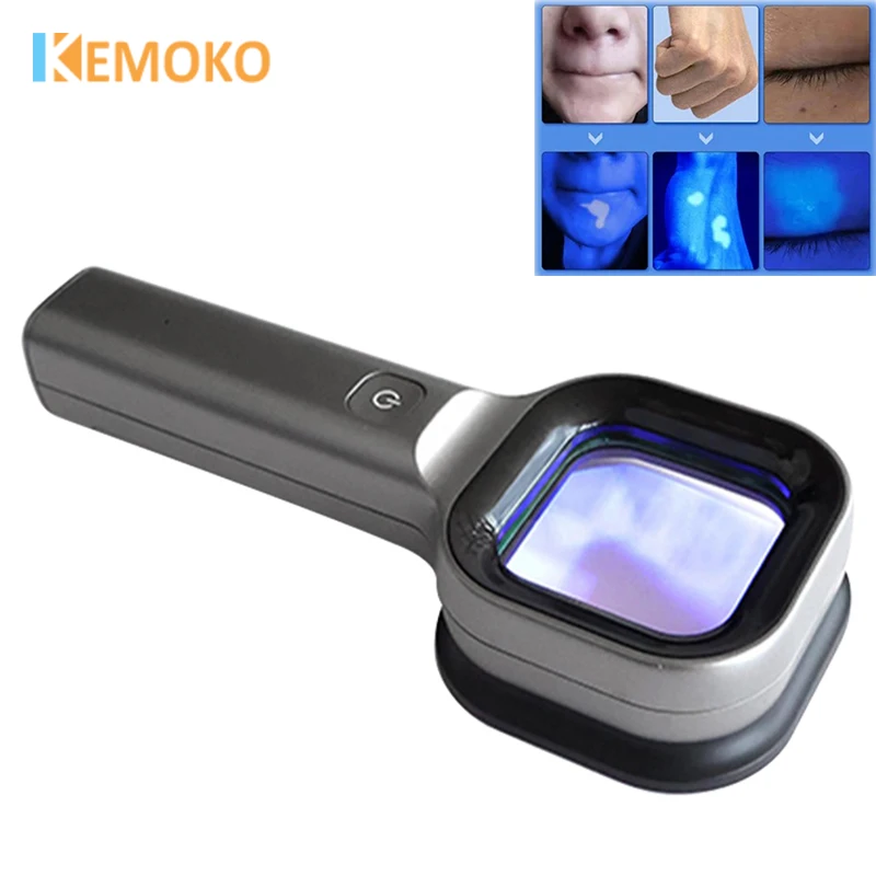 Woods Lamp Skin Analyzer Skin UV Magnifying Skin Testing Home Use Facial Testing Wood Light Face Analysis Detection Beauty Care