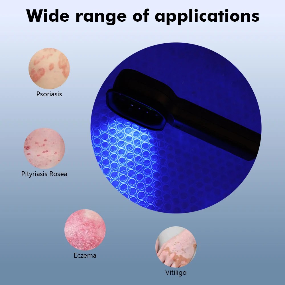 Woods Lamp Skin Analyzer Skin UV Magnifying Skin Testing Home Use Facial Testing Wood Light Face Analysis Detection Beauty Care - Image 5