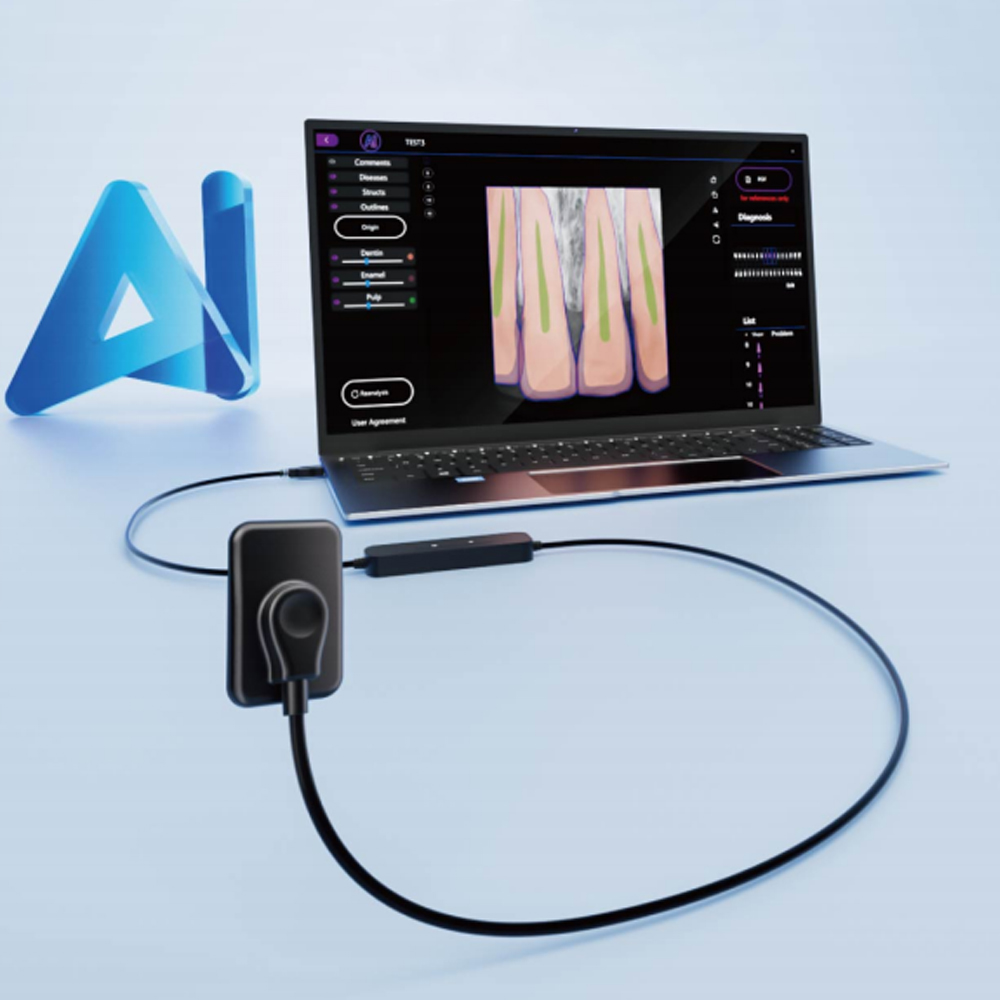 AI Diagnosis Dental Sensor X-Ray Sensor Digital Intraoral System Intra-Oral with Software 3m Cable Dyn Image  Fast Transmit