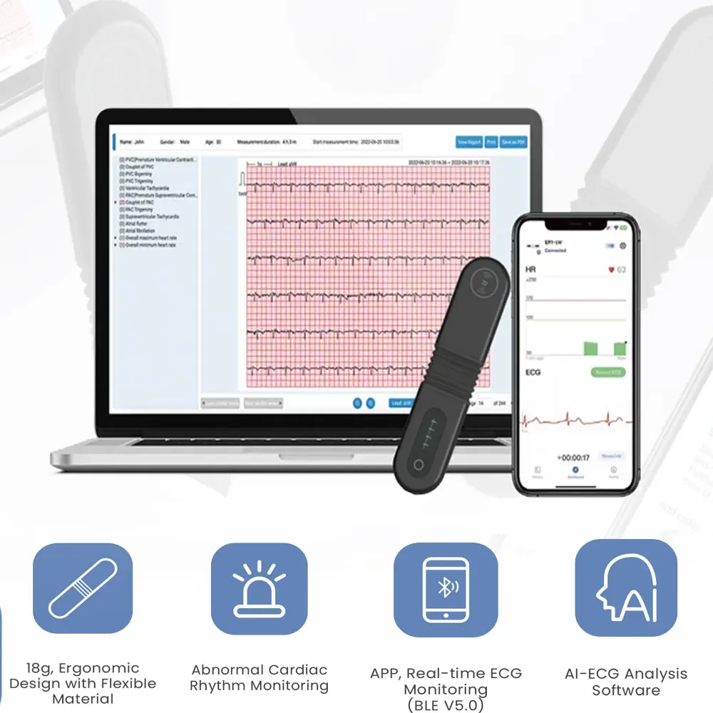 Bluetooth Dynamic ECG, Wearable Holter ECG, 24-hour Cardiac Abnormal Monitoring with AI Analysis Data Recording - Image 3