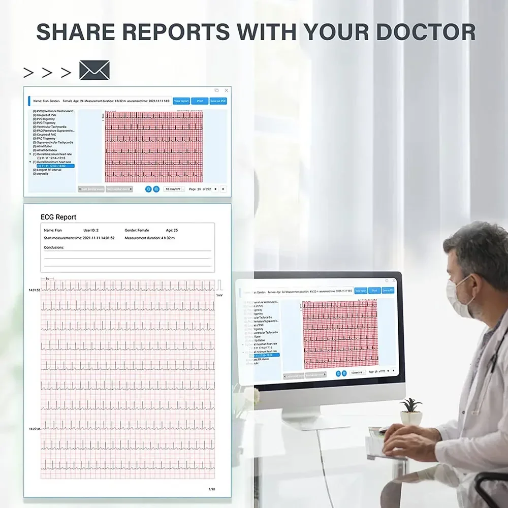 Bluetooth Dynamic ECG, Wearable Holter ECG, 24-hour Cardiac Abnormal Monitoring with AI Analysis Data Recording - Image 6