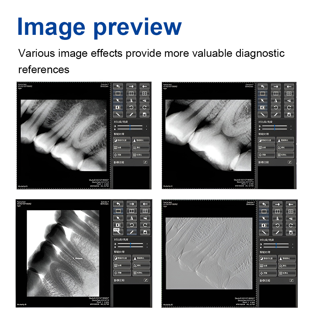 JINGT AI Dyn Image Dental X-ray Sensor Digital Intraoral System Fast Transmission 3m Cable with Software Dental Imaging Equipment - Image 3